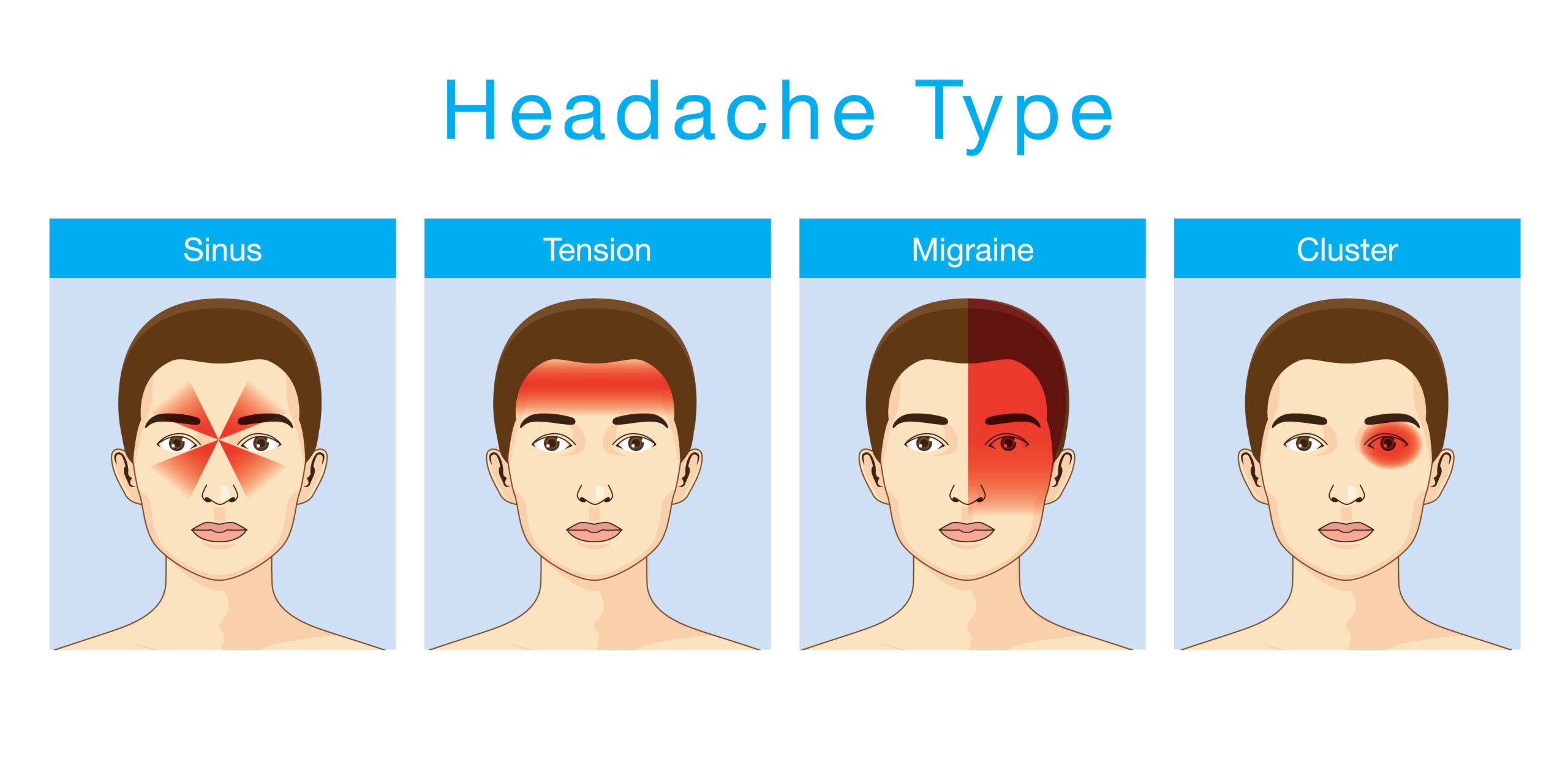 4 Main Types of Headaches