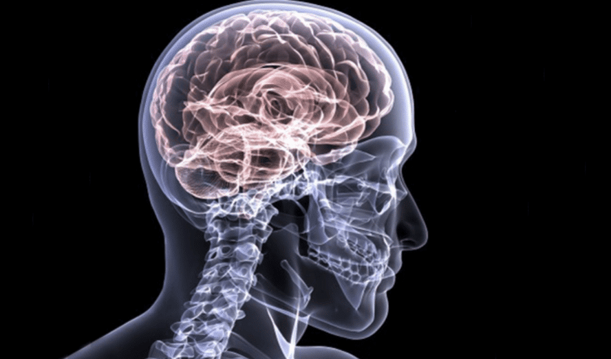 chronic organic brain injury in veterans