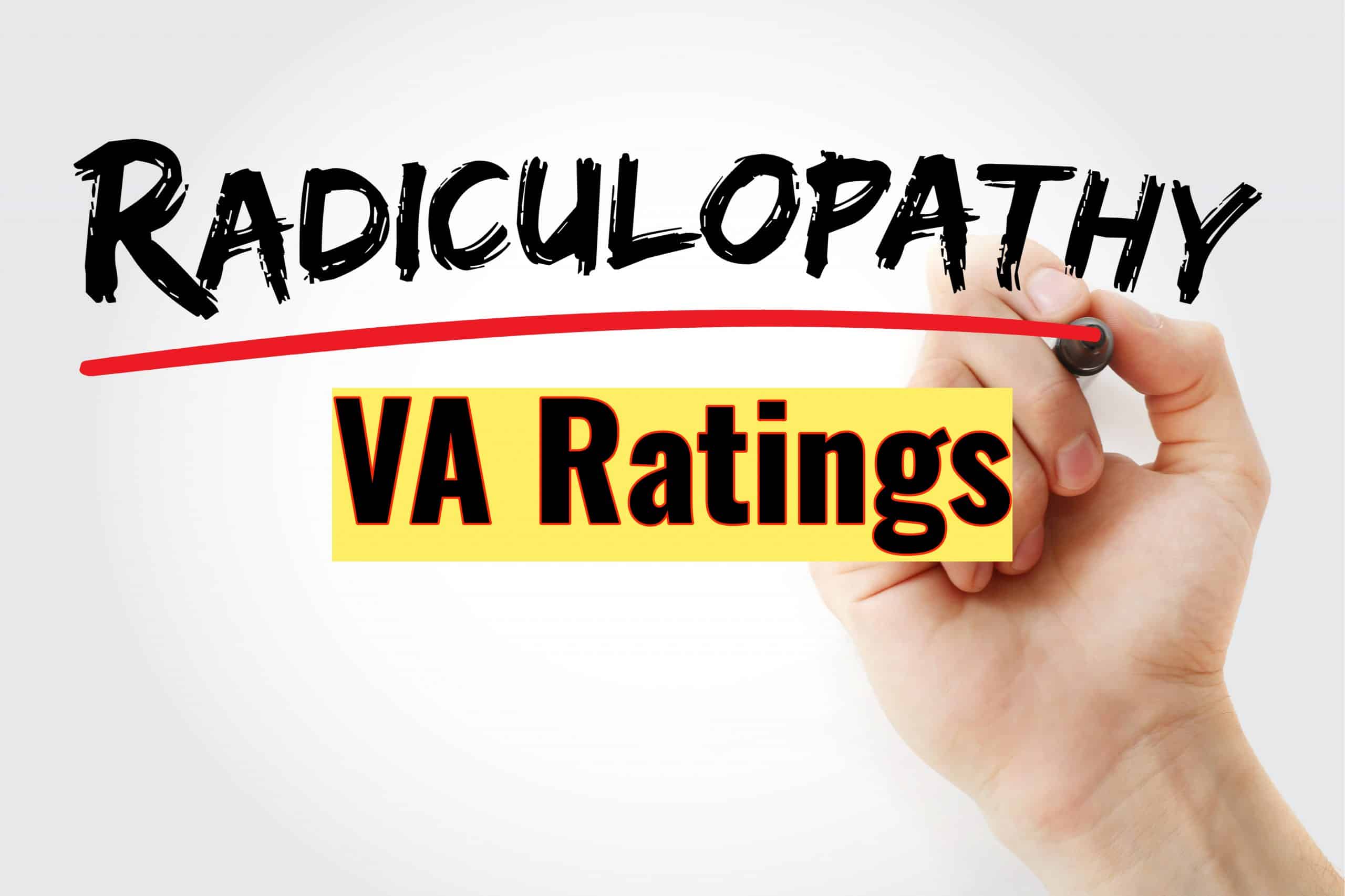 VA Disability Rating for Radiculopathy
